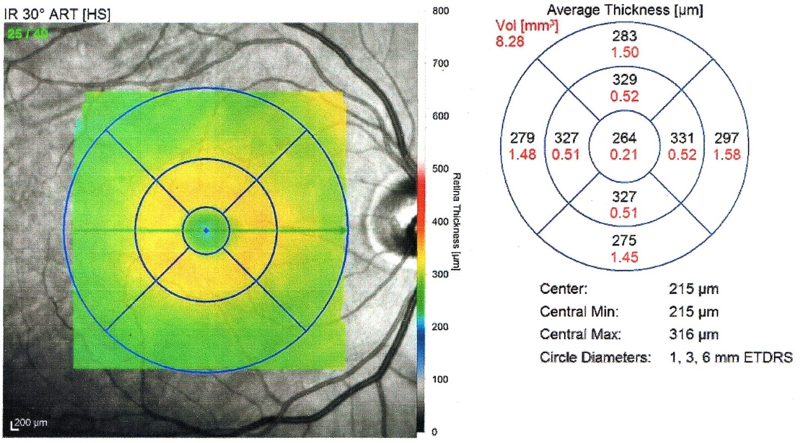 OCT Thickness Photo